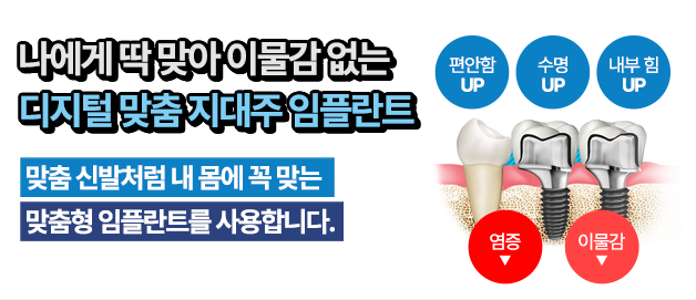 맞춤 임플란트