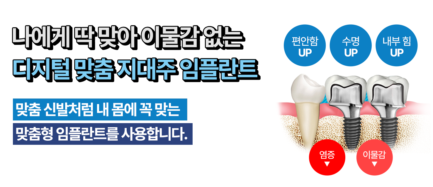 맞춤 임플란트